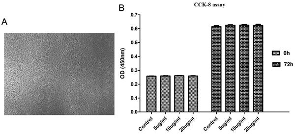 Fig. 1 Cell confluency level and CCK-8 assay results..tif