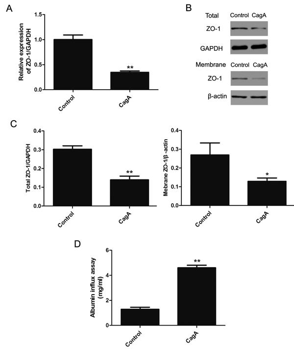 Fig. 3 CagA decreased the expression and membrane distribution of ZO-1, impaired filtration barrier function of mouse podocytes at 72 h of incubation..tif