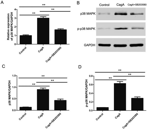 Fig. 4 CagA promoted p38 MAPK expression and phosphorylation in mouse podocytes at 72 h of incubation..tif