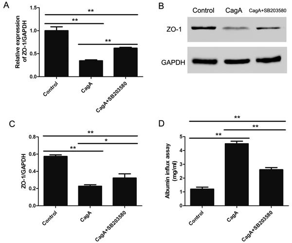 Fig. 5 Selective p38 MAPK inhibition improved ZO-1 expression and filtration barrier function in mouse podocytes treated with CagA for 72h..tif